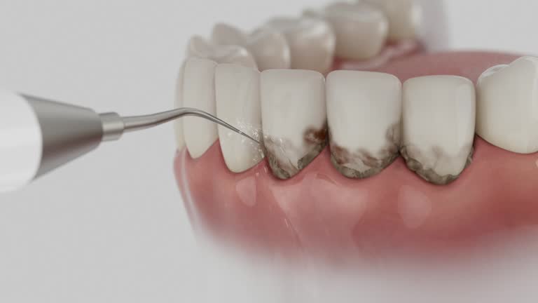 Reliable Emergency Dentist contractor in Fayette, MS by Smile Center Dentistry